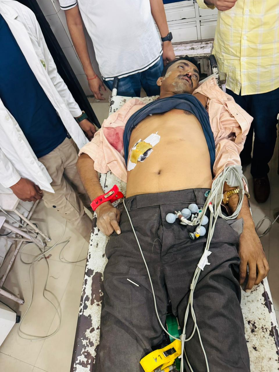 LUCKNOW:यूपी के गोंडा में पुलिस मुठभेड़ में ढेर हुआ एक लाख का ईनामी बदमाश