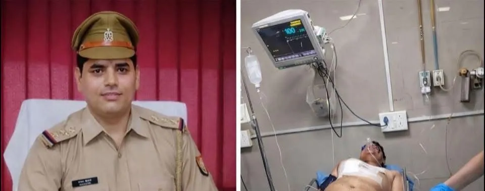 सुल्तानपुर: इंस्पेक्टर अरुण द्विवेदी की पिस्टल से चली गोली, कंधे में धंसी, पीजीआई में भर्ती